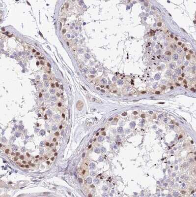 Immunohistochemistry-Paraffin: Bcl-9 Antibody [NBP2-30472] - Staining of human testis shows moderate nuclear positivity in cells in seminiferous ducts.