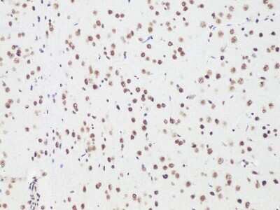 Immunohistochemistry-Paraffin Bcl-9 Antibody - BSA Free