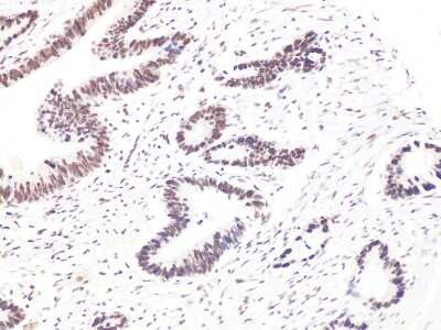 Immunohistochemistry-Paraffin Bcl-9 Antibody - BSA Free