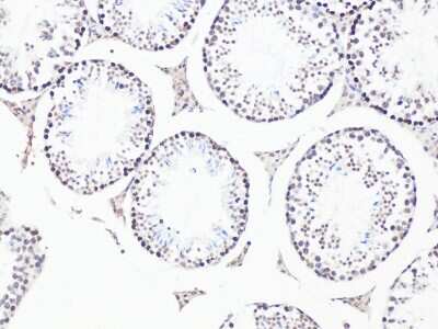 Immunohistochemistry-Paraffin: Bcl-9 Antibody [NBP3-05612] - Immunohistochemistry of paraffin-embedded Mouse testis using Bcl-9 antibody (NBP3-05612) at dilution of 1:100 (20x lens).