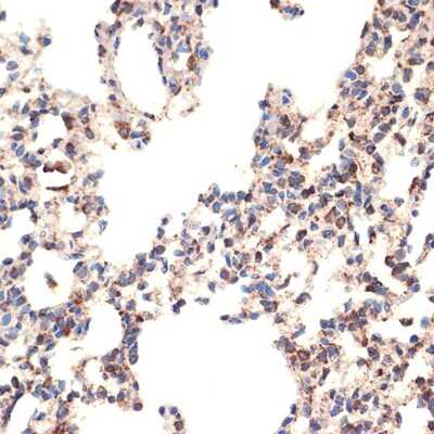 Immunohistochemistry-Paraffin: Bcl G Antibody (6R9F3) [NBP3-15746] - Immunohistochemistry of paraffin-embedded rat lung using BCL2L14/Bcl G Rabbit mAb (NBP3-15746) at dilution of 1:100 (40x lens).Perform microwave antigen retrieval with 10 mM Tris/EDTA buffer pH 9.0 before commencing with IHC staining protocol.