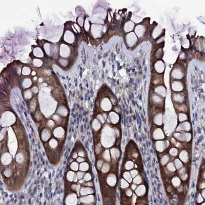 Immunohistochemistry-Paraffin: Bcl G Antibody [NBP1-91697] - Staining of human rectum shows high expression.