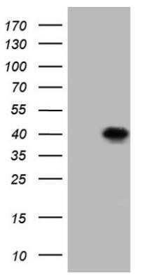 Western Blot: Bcl G Antibody (OTI6D1) - Azide and BSA Free [NBP2-72204] - HEK293T cells were transfected with the pCMV6-ENTRY control (Left lane) or pCMV6-ENTRY BCL2L14 (Right lane) cDNA for 48 hrs and lysed. Equivalent amounts of cell lysates (5 ug per lane) were separated by SDS-PAGE and immunoblotted with anti-BCL2.
