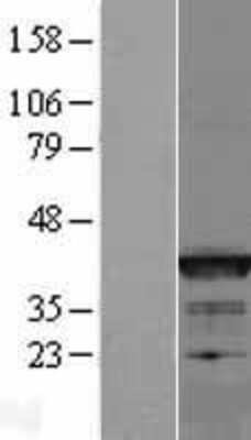 Western Blot: Bcl G Overexpression Lysate (Adult Normal) [NBP2-05634] Left-Empty vector transfected control cell lysate (HEK293 cell lysate); Right -Over-expression Lysate for Bcl G.