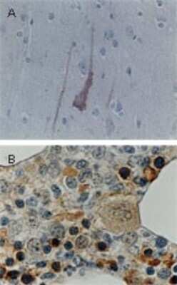 Immunohistochemistry-Paraffin: Bcl-xL Antibody [NB100-56105] - FFPE human tissue sections stained for Bcl-X expression using this antibody at 1:2000. (A) Cortex from the brain of an Alzheimer's disease patient. The degenerating neurons are positive for BclX expression, the intact neurons are not. (B) Normal bone marrow. The cells positive for Bcl-X expression appear to be of erythropoetic lineage. Hematoxylin-eosin counterstain.