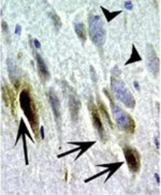 Immunohistochemistry-Paraffin: Bcl-xL Antibody [NB100-56105] - FFPE section of dog ischemic brain cortex stained for Bcl-X expression using this antibody at 1:2000. At 2 hr post ischemia, Bcl-X staining was seen in the dying neurons that had morphological features of apoptosis (arrows). In contrast, mophologically normal appearing neurons lacked Bcl-X staining (arrowheads). Hematoxylin-eosin counterstain.