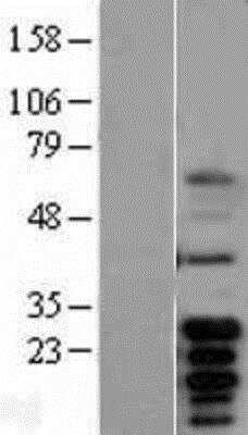 Western Blot: Bcl-Xl Overexpression Lysate (Native) [NBL1-07946] - Left-Empty vector transfected control cell lysate (HEK293 cell lysate); Right -Bcl-Xl Overexpression Lysate (Native).