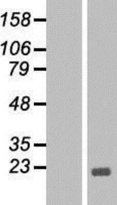 Western Blot: Bcl-Xl Overexpression Lysate (Native) [NBP2-08227] - Bcl-Xl Overexpression Lysate (Native) Left-Empty vector transfected control cell lysate (HEK293 cell lysate); Right -Over-expression Lysate for BCL2L1.