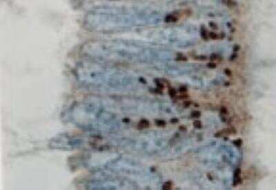 Immunohistochemistry-Paraffin: Bcl-xL Antibody [NB100-56103] - FFPE normal human colon epithelium tissue section stained for Bcl-X expression at 1:2000. Hematoxylin-eosin counterstain. A course granular Bcl-X staining pattern associated with the mitochondria is observed.