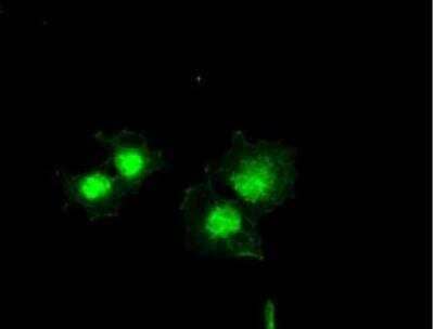 Immunocytochemistry/Immunofluorescence: Bcl-xL Antibody (OTI4A9) - Azide and BSA Free [NBP2-70247] - Staining of COS7 cells transiently transfected by pCMV6-ENTRY BCL2L1 (1:100).