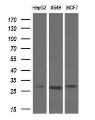 Western Blot: Bcl-xL Antibody (OTI4A9) - Azide and BSA Free [NBP2-70247] - Analysis of extracts (10ug) from 3 different cell lines by using anti-BCL-XL monoclonal antibody (1:200).