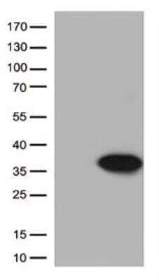 Western Blot: Bcl-xL Antibody (OTI4A9) - Azide and BSA Free [NBP2-70247] - HEK293T cells were transfected with the pCMV6-ENTRY control (Left lane) or pCMV6-ENTRY BCL2L1 ( Right lane) cDNA for 48 hrs and lysed. Equivalent amounts of cell lysates (5 ug per lane) were separated by SDS-PAGE and immunoblotted with anti-BCL2L1 (1:500)