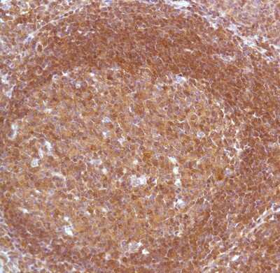 Immunohistochemistry-Paraffin: Bcl10 Antibody (SPM520) [NBP1-35331] Human Tonsil