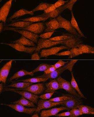 Immunocytochemistry/ Immunofluorescence Bcl3 Antibody - Azide and BSA Free