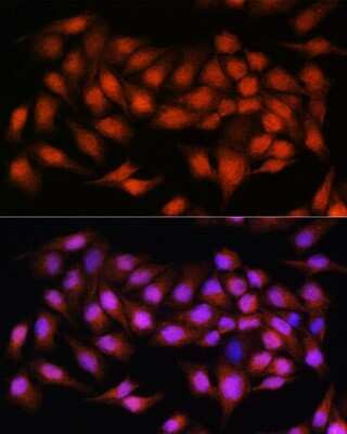 Immunocytochemistry/ Immunofluorescence Bcl3 Antibody - Azide and BSA Free