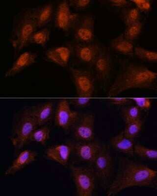 Immunocytochemistry/Immunofluorescence: Bcl3 Antibody [NBP2-92041] - Immunofluorescence analysis of C6 cells using Bcl3 Rabbit pAb (NBP2-92041) at dilution of 1:100. Blue: DAPI for nuclear staining.