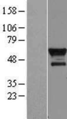 Western Blot Bcl3 Overexpression Lysate
