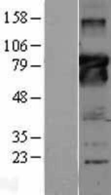 Western Blot: Bcl6 Overexpression Lysate (Adult Normal) [NBL1-07951] - Western Blot experiments.  Left-Control; Right -Over-expression Lysate for BCL6.