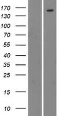 Western Blot: Bcr Overexpression Lysate (Adult Normal) [NBP2-06527] Left-Empty vector transfected control cell lysate (HEK293 cell lysate); Right -Over-expression Lysate for Bcr.