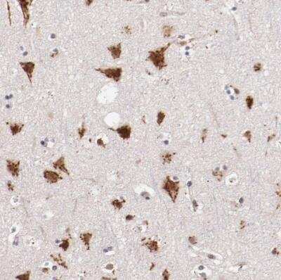 Immunohistochemistry-Paraffin Begain Antibody - BSA Free