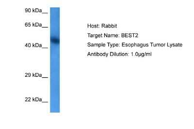 Western Blot: Bestrophin 2 Antibody [NBP2-84503] - Host: Rabbit. Target Name: BEST2. Sample Tissue: Esophagus Tumor lysates. Antibody Dilution: 1ug/ml