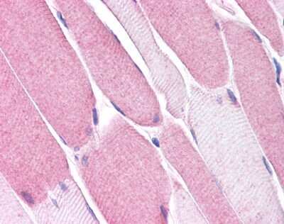 Immunohistochemistry-Paraffin: Bestrophin 3 Antibody [NB110-55617] - Analysis of anti-BEST3 antibody with human skeletal muscle.
