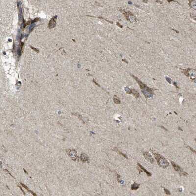 Immunohistochemistry-Paraffin: Beta-1,3-N-Acetylglucosaminyltransferase 1/B3GNT1 Antibody [NBP1-88952] - Staining of human hippocampus shows strong cytoplasmic positivity in neuronal cells.