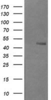 Western Blot: Beta-1,3-N-Acetylglucosaminyltransferase 2/B3GNT2 Antibody (OTI3A9) [NBP2-45527] - Analysis of HEK293T cells were transfected with the pCMV6-ENTRY control (Left lane) or pCMV6-ENTRY B3GNT2.