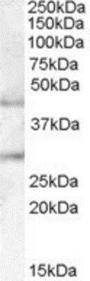 Western Blot: Beta-1,3-N-Acetylglucosaminyltransferase 2/B3GNT2 Antibody [NBP1-00158] - (0.1ug/ml) staining of Human Pancreas lysate (35ug protein in RIPA buffer). Primary incubation was 1 hour. Detected by chemiluminescence.