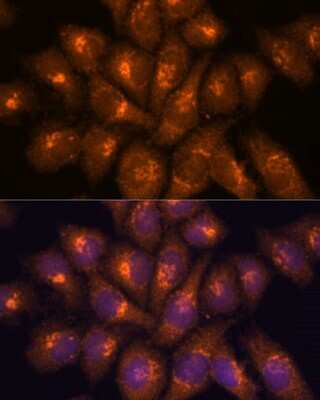 Immunocytochemistry/ Immunofluorescence Beta-1,3-N-Acetylglucosaminyltransferase 4/B3GNT4 Antibody - Azide and BSA Free