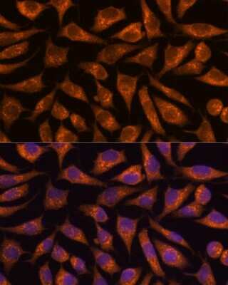Immunocytochemistry/ Immunofluorescence Beta-1,3-N-Acetylglucosaminyltransferase 4/B3GNT4 Antibody - Azide and BSA Free