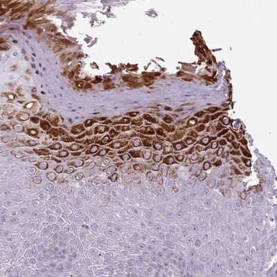 Immunohistochemistry-Paraffin: Beta-1,3-N-Acetylglucosaminyltransferase 4/B3GNT4 Antibody [NBP2-30927] - Staining of human skin shows cytoplasmic positivity in epidermal cells.