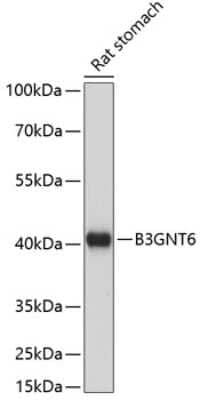 Western Blot: Beta-1,3-N-Acetylglucosaminyltransferase 6/B3GNT6 Antibody [NBP2-92200] - Analysis of extracts of rat stomach, using Beta-1,3-N-Acetylglucosaminyltransferase 6/B3GNT6 at 1:1000 dilution.Secondary antibody: HRP Goat Anti-Rabbit IgG (H+L) at 1:10000 dilution.Lysates/proteins: 25ug per lane.Blocking buffer: 3% nonfat dry milk in TBST.Detection: ECL Basic Kit .Exposure time: 60s.