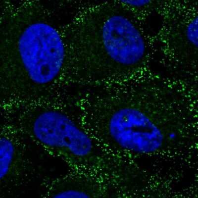 Immunocytochemistry/Immunofluorescence: Beta 2 Adaptin Antibody [NBP2-58316] - Staining of human cell line U-251 MG shows localization to vesicles.