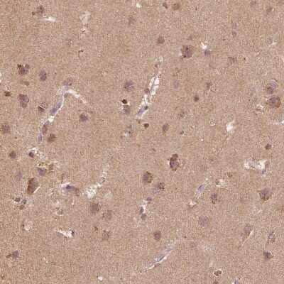 Immunohistochemistry-Paraffin: Beta 2 Adaptin Antibody [NBP2-68864] - Immunohistochemical staining of human cerebral cortex shows strong cytoplasmic positivity in neuronal cells.