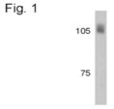 Western Blot: Beta 2 Adaptin Antibody [NB100-74371] - Analysis of bovine brain.