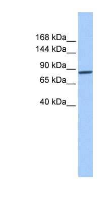 Western Blot: Beta 2 Adaptin Antibody [NBP1-56481] - Human Liver cell lysate, concentration 0.2-1 ug/ml.