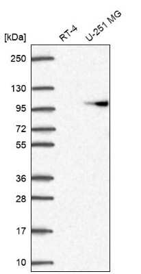 Western Blot: Beta 2 Adaptin Antibody [NBP2-58316] - Analysis in human cell line RT-4 and human cell line U-251 MG.