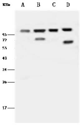 Western Blot: Beta 2 Adaptin Antibody [NBP2-99455] - Anti-Beta 2 Adaptin rabbit polyclonal antibody at 1:500 dilution. Lane A: HeLa Whole Cell Lysate Lane B: Jurkat Whole Cell Lysate Lane C: K562 Whole Cell Lysate Lane D: A431 Whole Cell Lysate Lysates/proteins at 30 ug per lane. Secondary Goat Anti-Rabbit IgG (H+L)/HRP at 1/10000 dilution. Developed using the ECL technique. Performed under reducing conditions. Predicted band size: 105 kDa. Observed band size: 105 kDa