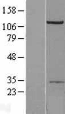 Western Blot: Beta 2 Adaptin Overexpression Lysate (Adult Normal) [NBL1-07579] Left-Empty vector transfected control cell lysate (HEK293 cell lysate); Right -Over-expression Lysate for Beta 2 Adaptin.