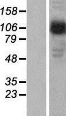 Western Blot: Beta 2 Adaptin Overexpression Lysate (Adult Normal) [NBP2-10970] Left-Empty vector transfected control cell lysate (HEK293 cell lysate); Right -Over-expression Lysate for Beta 2 Adaptin.