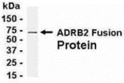 Western Blot: Beta 2 Adrenergic Receptor Antibody [NB120-13989] - E coli-derived fusion protein as test antigen. Affi-pure IgY dilution: 1:2000, Goat anti-IgY-HRP dilution: 1:1000. Colorimetric method for signal development. ( anti-ADRB2 )