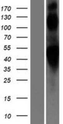 Western Blot beta-2 Adrenergic R/ADRB2 Overexpression Lysate