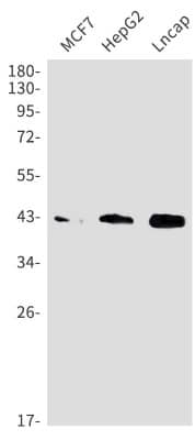 Western Blot: Beta Dystroglycan Antibody (S05-5B5) [NBP3-19985] - Western blot detection of Beta Dystroglycan in MCF7, HepG2, Lncap cell lysates using NBP3-19985 (1:1000 diluted). Predicted band size: 27kDa. Observed band size: 42-44kDa.