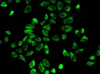 Immunocytochemistry/ Immunofluorescence Beta Hydroxysteroid Dehydrogenase Antibody - Azide and BSA Free