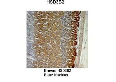 Immunohistochemistry: Beta Hydroxysteroid Dehydrogenase Antibody [NBP1-59531] - Monkey adrenal gland Primary Antibody Dilution: 1 : 25 Secondary Antibody: Anti-rabbit-HRP Secondary Antibody Dilution: 1 : 1000 Color/Signal Descriptions: Brown: HSD3B2 Blue: Nucleus Gene name: HSD3B2 Submitted by: Jonathan Bertin, Endoceutics Inc.