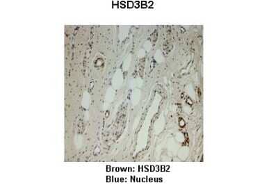 Immunohistochemistry: Beta Hydroxysteroid Dehydrogenase Antibody [NBP1-59531] - Monkey vagina Primary Antibody Dilution: 1 : 25 Secondary Antibody: Anti-rabbit-HRP Secondary Antibody Dilution: 1 : 1000 Color/Signal Descriptions: Brown: HSD3B2 Blue: Nucleus Gene name: HSD3B2 Submitted by: Jonathan Bertin, Endoceutics Inc.