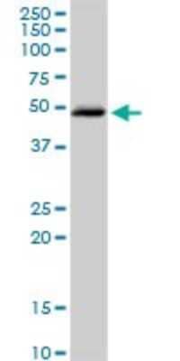 Western Blot: Beta Hydroxysteroid Dehydrogenase Antibody [H00003284-D01P] - Analysis of HSD3B2 expression in human placenta.
