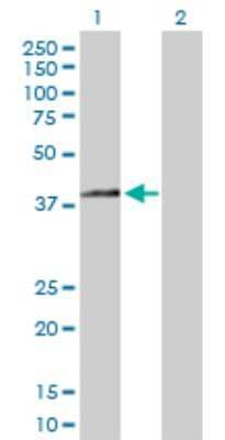 Western Blot: Beta Hydroxysteroid Dehydrogenase Antibody [H00003284-D01P] - Analysis of HSD3B2 expression in transfected 293T cell line by HSD3B2 polyclonal antibody.Lane 1: HSD3B2 transfected lysate(42.10 KDa).Lane 2: Non-transfected lysate.