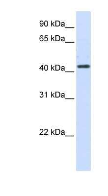 Western Blot Beta Hydroxysteroid Dehydrogenase Antibody - BSA Free